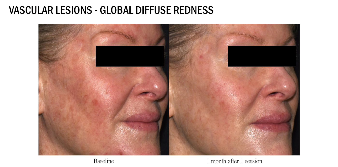 可調式智冷系統