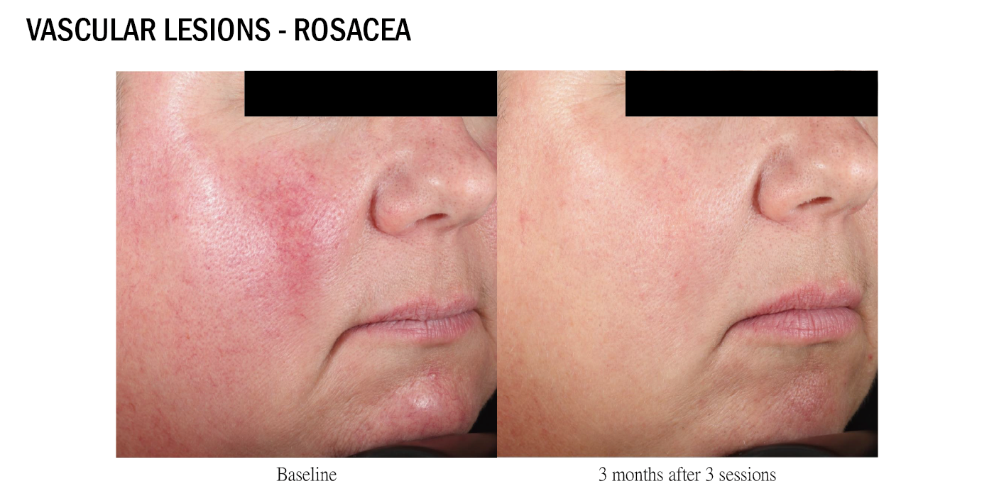 可調式智冷系統