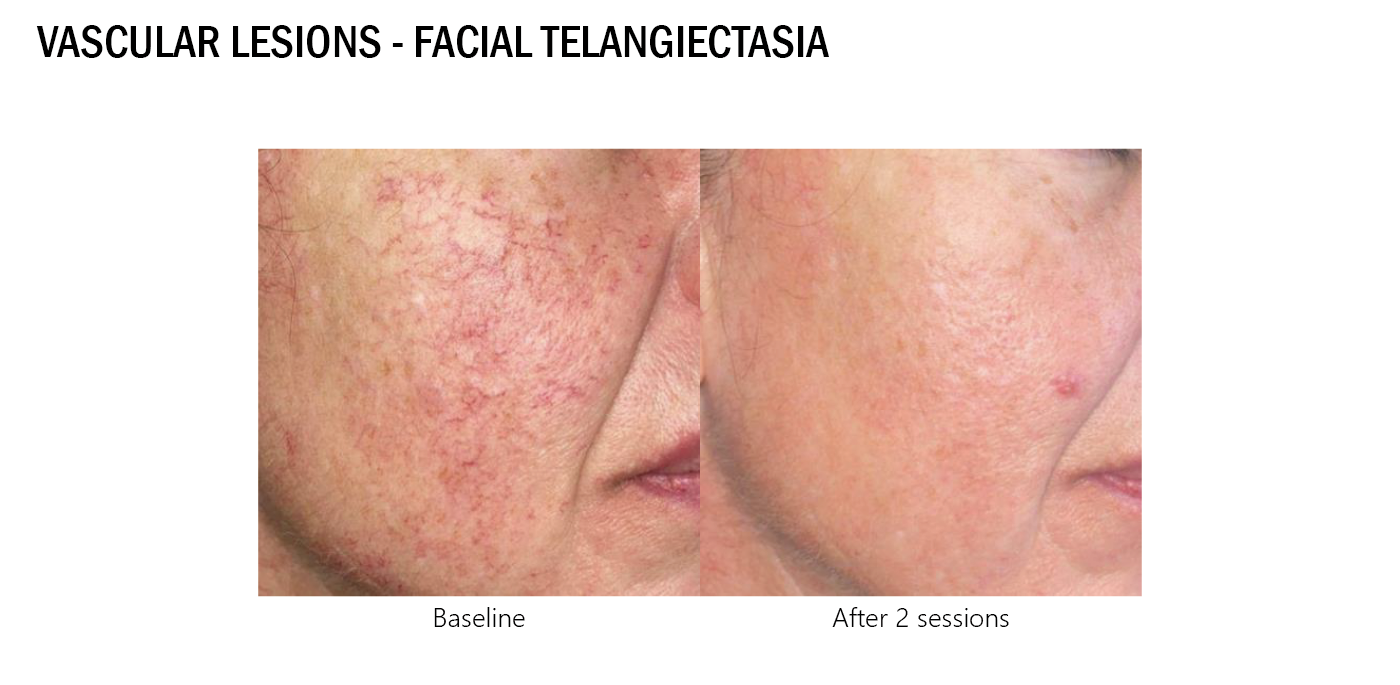 可調式智冷系統