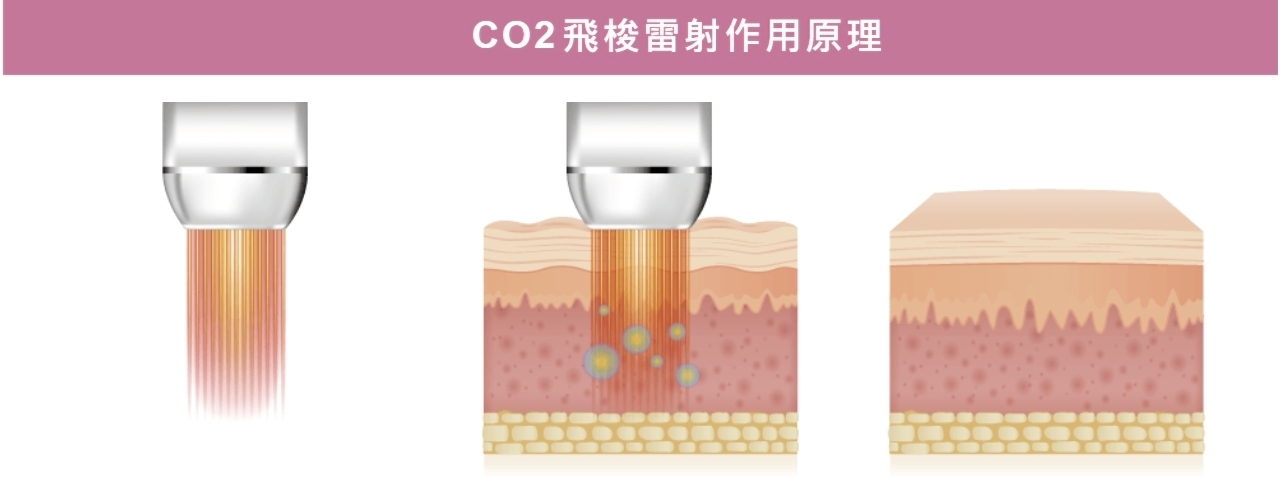 可調式智冷系統