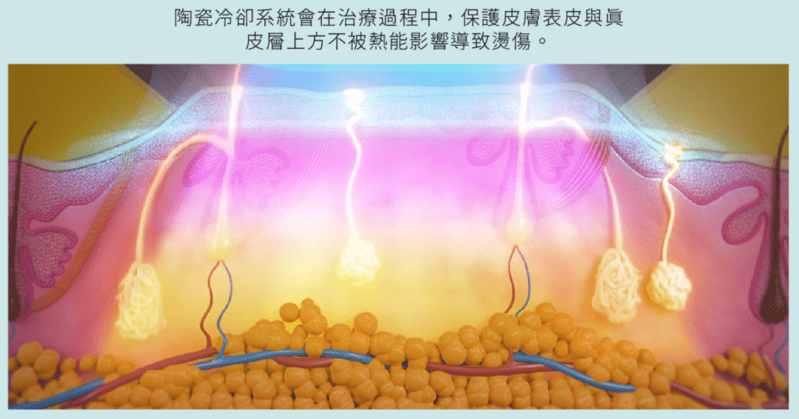 可調式智冷系統
