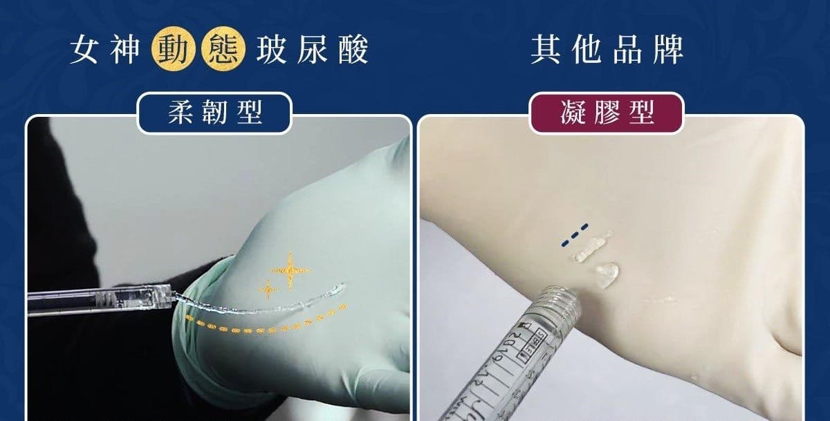 動態玻尿酸