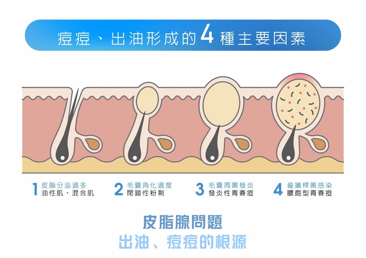 出油原因